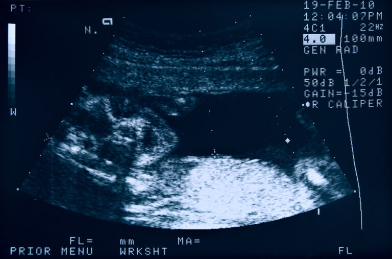 lawmakers,-activists-rally-behind-proposed-ban-of-‘inhumane’-dismemberment-abortion